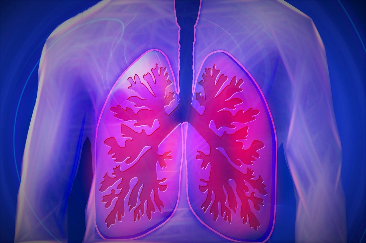肺のレントゲン写真